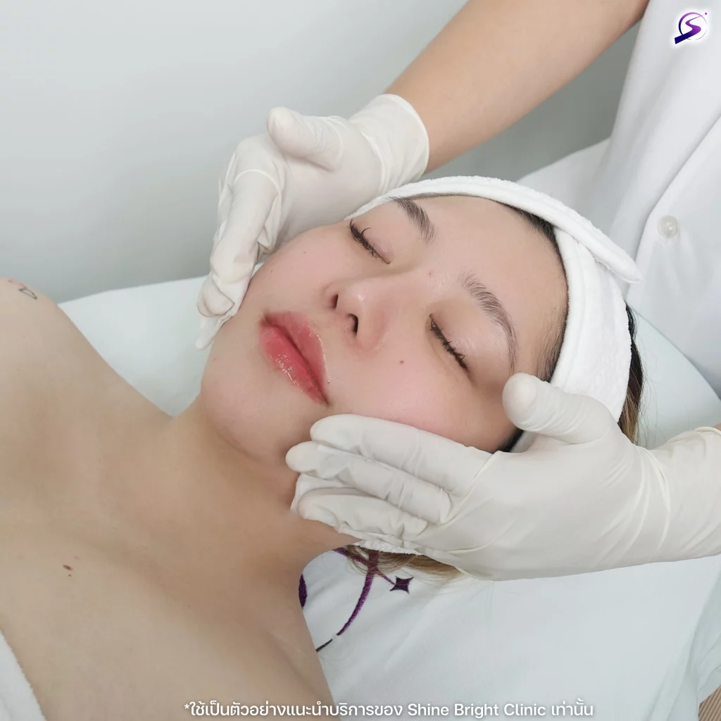 Program กระตุ้นการสร้าง Collagen ด้วย Biostimulator